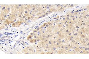 Detection of MAPKAP1 in Human Liver Tissue using Polyclonal Antibody to Mitogen Activated Protein Kinase Associated Protein 1 (MAPKAP1) (MAPKAP1 antibody  (AA 8-236))