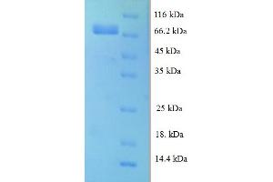 SDS-PAGE (SDS) image for Leucine Rich Repeat Containing 40 (LRRC40) (AA 1-602), (full length) protein (His tag) (ABIN5711891)