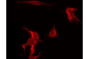 ABIN6269110 staining HuvEc by IF/ICC. (beta 2 Adrenergic Receptor antibody  (C-Term))