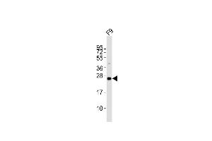 Anti-Lin28a Antibody (C-term)at 1:2000 dilution + F9 whole cell lysates Lysates/proteins at 20 μg per lane. (LIN28A antibody  (C-Term))