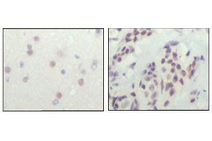 anti-Nuclear Receptor Co-Repressor 1 (NCOR1) antibody