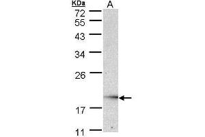 WB Image Sample (30 ug of whole cell lysate) A: Raji , 12% SDS PAGE antibody diluted at 1:1000 (UBE2G2 antibody)