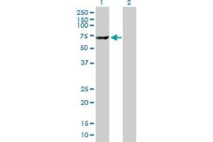 Western Blot analysis of CES1 expression in transfected 293T cell line by CES1 MaxPab polyclonal antibody. (CES1 antibody  (AA 1-566))