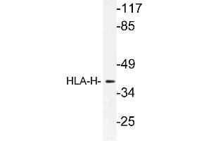 Western blot (WB) analysis of HLA-H antibody in extracts from LOVO cells.