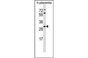 Western blot analysis in human placenta tissue lysates (35ug/lane) using STARD4 Antibody (N-term) Cat.