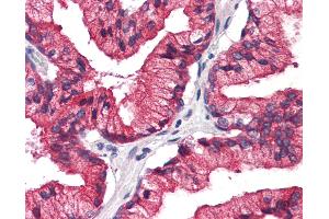 Human, Prostate: Formalin-Fixed Paraffin-Embedded (FFPE) (REEP5 antibody  (C-Term))