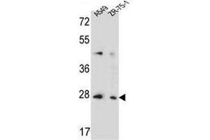 T4S4 Antibody (N-term) western blot analysis in A549,ZR-75-1 cell line lysates (35µg/lane).