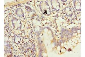 Immunohistochemistry of paraffin-embedded human small intestine tissue using ABIN7174699 at dilution of 1:100 (AKNA Domain Containing 1 (AKNAD1) (AA 1-223) antibody)