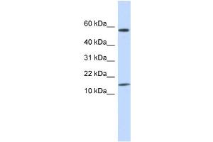 WB Suggested Anti-KRTAP11-1 Antibody Titration:  0. (KRTAP11-1 antibody  (N-Term))