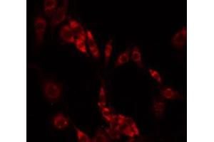ABIN6275466 staining HeLa by IF/ICC. (RAB33A antibody  (Internal Region))