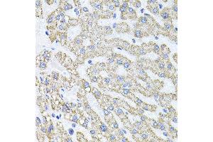 Immunohistochemistry of paraffin-embedded human liver injury using SDC2 antibody at dilution of 1:100 (x40 lens). (Syndecan 2 antibody)