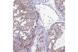 Immunohistochemical staining of human testis with C14orf1 polyclonal antibody  shows distinct staining in spermatids. (C14orf1 antibody)