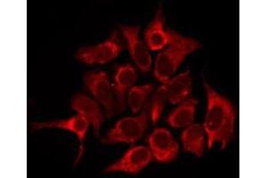 ABIN6276262 staining NIH-3T3 by IF/ICC. (OR2W3 antibody)