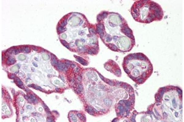 KRT23 antibody  (C-Term)