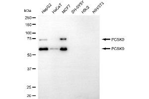 Western blotting analysis using PCSK9 antibody (ABIN7799927).