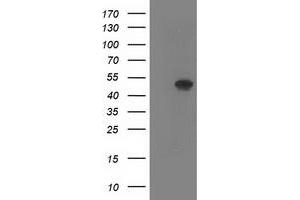 Western Blotting (WB) image for anti-SET Domain Containing (Lysine Methyltransferase) 7 (SETD7) antibody (ABIN1500904) (SETD7 antibody)