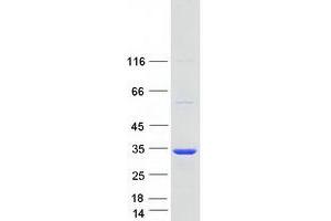 Western Blotting (WB) image for SCAN Domain Containing 1 (SCAND1) (Transcript Variant 1) protein (Myc-DYKDDDDK Tag) (ABIN2731439)