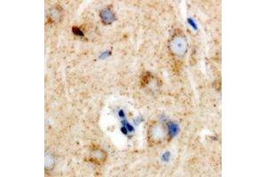 Immunohistochemical analysis of Ribophorin-2 staining in rat brain formalin fixed paraffin embedded tissue section.