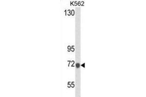 Western Blotting (WB) image for anti-Lactotransferrin (LTF) antibody (ABIN2995307) (Lactoferrin antibody)