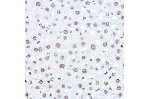 Immunohistochemistry of paraffin-embedded rat liver using SETD5 Rabbit pAb (ABIN6132960, ABIN6147644, ABIN6147646 and ABIN6223140) at dilution of 1:100 (40x lens). (SETD5 antibody  (AA 520-740))