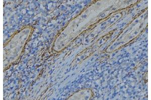 ABIN6274996 at 1/100 staining Human uterus tissue by IHC-P. (CBLN4 antibody  (Internal Region))