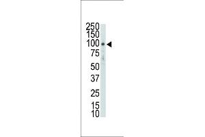 Western blot analysis of DDR2 (TYRO10) Antibody ap7689a in HL-60 lysate. (DDR2 antibody  (AA 290-320))