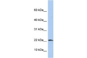 WB Suggested Anti-IL1B Antibody Titration: 0. (IL-1 beta antibody  (N-Term))