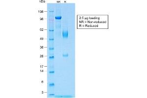 SDS-PAGE Analysis of Purified Wilm's Tumor Rabbit Recombinant Monoclonal Antibody (WT1/1434R). (Recombinant WT1 antibody)