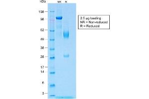 SDS-PAGE Analysis of Purified Wilm's Tumor Rabbit Recombinant Monoclonal Antibody (WT1/1434R).