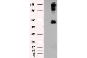 HEK293T cells were transfected with the pCMV6-ENTRY control (Left lane) or pCMV6-ENTRY LIPG (Right lane) cDNA for 48 hrs and lysed. (LIPG antibody)