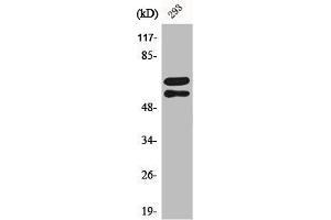 Western Blot analysis of 293 cells using Phospho-Lyn (Y508) Polyclonal Antibody (LYN antibody  (pTyr508))