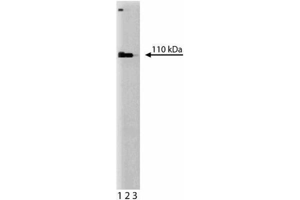 PPP1R10 Antikörper  (AA 605-716)