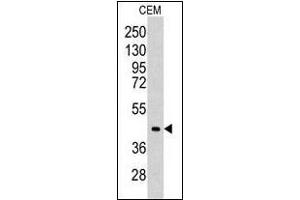 Western blot analysis of CEM cell line lysates (35 µg/lane). (ALDOC antibody  (C-Term))