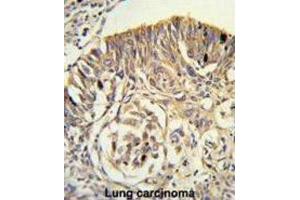Immunohistochemistry (IHC) image for anti-Phospholipid Transfer Protein (PLTP) antibody (ABIN3003343) (PLTP antibody)