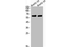Western Blot analysis of HepG2-UV cells using Acetyl-Cortactin (K235) Polyclonal Antibody (Cortactin antibody  (acLys235))