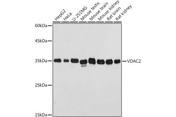 VDAC2 antibody  (AA 1-100)