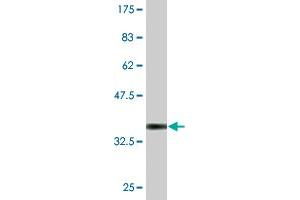 Western Blot detection against Immunogen (36. (Esterase D antibody  (AA 183-281))