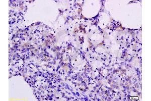 Formalin-fixed and paraffin embedded rat lung labeled with Anti-CXCL10 Polyclonal Antibody, Unconjugated (ABIN687442) at 1:200 followed by conjugation to the secondary antibody and DAB staining. (CXCL10 antibody  (AA 35-98))