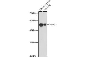 Western blot analysis of extracts of various cell lines, using RBM22 antibody (ABIN6127306, ABIN6146767, ABIN6146768 and ABIN6214130) at 1:1000 dilution. (RBM22 antibody  (AA 1-230))