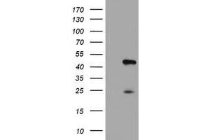 Western Blotting (WB) image for anti-Centromere Protein H (CENPH) antibody (ABIN1497474)