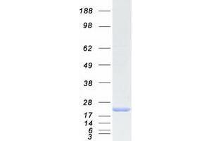Validation with Western Blot (Myoglobin Protein (MB) (Transcript Variant 1) (Myc-DYKDDDDK Tag))