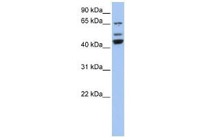 WB Suggested Anti-VPS4A Antibody Titration: 0. (VPS4A antibody  (N-Term))