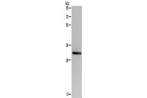 Western Blotting (WB) image for anti-Intercellular Adhesion Molecule 4 (ICAM4) antibody (ABIN2430281) (ICAM4 antibody)