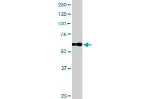 CALD1 MaxPab rabbit polyclonal antibody. (Caldesmon antibody  (AA 1-538))