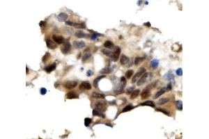 IHC analysis of OGT using anti-OGT antibody (ABIN3043893). (OGT antibody  (C-Term))