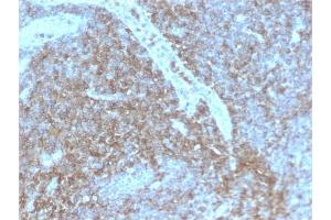 Formalin-fixed, paraffin-embedded human Lymph Node stained with CD44 Rabbit Recombinant Monoclonal Antibody (HCAM/2875R). (Recombinant CD44 antibody)