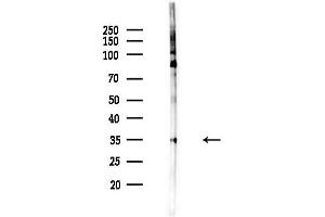 anti-Protein Phosphatase 1, Catalytic Subunit, alpha Isoform (PPP1CA) (C-Term) antibody