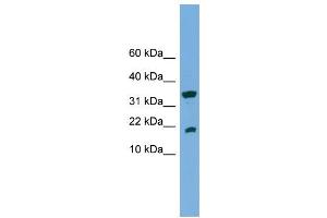 WB Suggested Anti-ACP1  Antibody Titration: 0. (ACP1 antibody  (Middle Region))