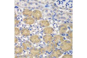 Immunohistochemistry of paraffin-embedded mouse kidney using SND1 antibody at dilution of 1:100 (40x lens). (SND1 antibody)