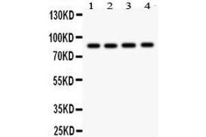 Western Blotting (WB) image for anti-NADPH Oxidase 5 (NOX5) (AA 747-765), (C-Term) antibody (ABIN3042984) (NOX5 antibody  (C-Term))